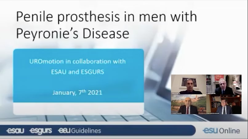 Title slide of the EAU UROmotion session “Penile prosthesis in men with Peyronie’s Disease”, produced with ESAU and ESGURS, with the faculty panel shown alongside.